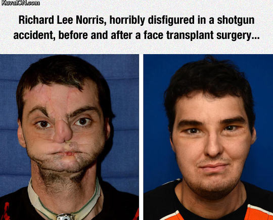 this_surgeon_did_a_fantastic_job.jpg