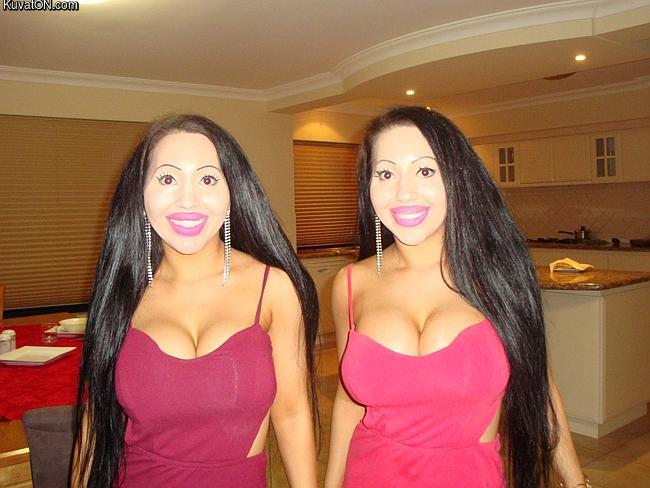 twins_share_addiction_to_plastic_surgery.jpg